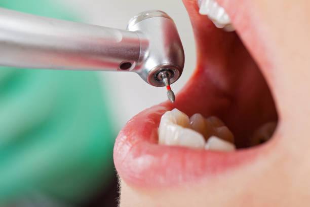 Best Cracked Tooth Emergency Dentist  in Pinewood, FL